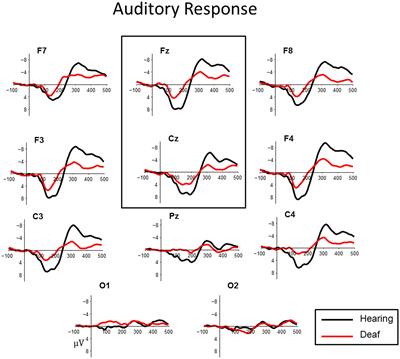 Auditory and Visual Electrophysiology of Deaf Children with Cochlear Implants: Implications for Cross-modal Plasticity